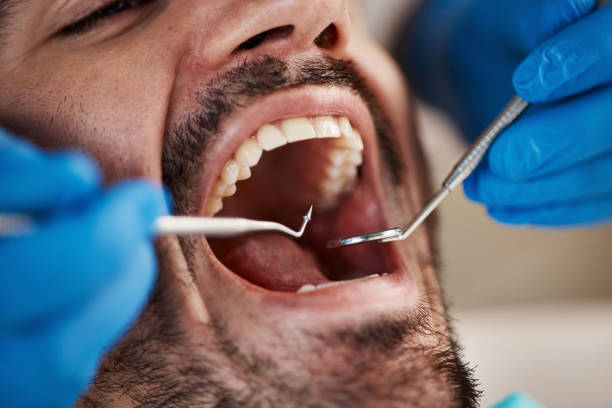 Best Mobile Emergency Dentist in USA
